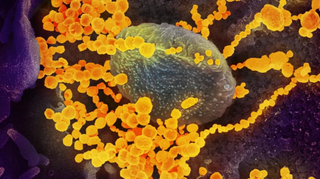 Nákaza novým koronavirem (žluté kuličky)