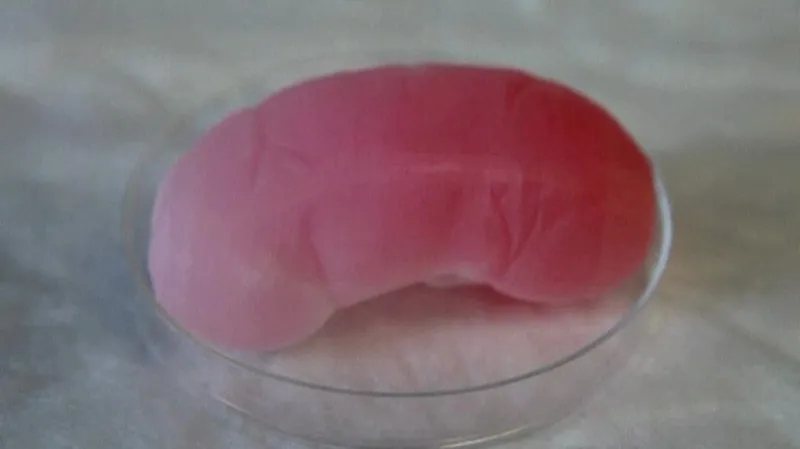 Vypěstovaná ledvina