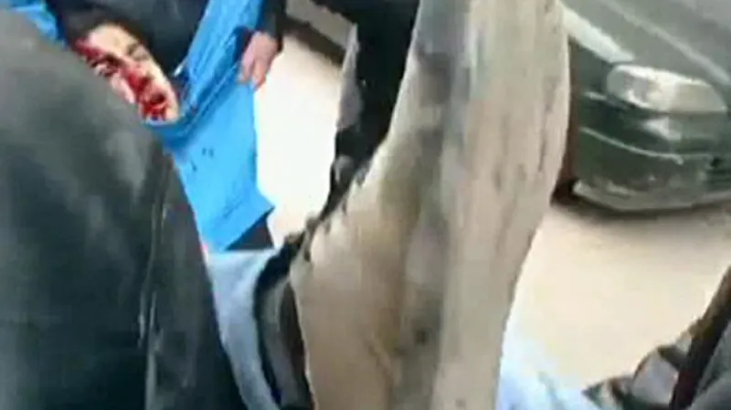 Zraněný demonstrant v Sýrii