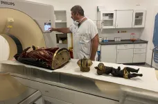 Brněnská Černá Madona byla na vyšetření v nemocnici. Tomograf zjistil poškození červotočem