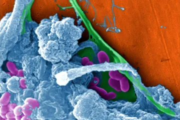 Ekosystém lidské smrti. Vědci popsali dvacet mikrobů, kteří přicházejí, když člověk odejde
