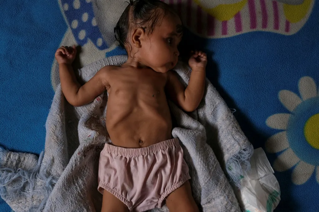 Sedmiměsíční Sonia ztratila během měsíce kilogram. Vážila šest a nyní má pět kilogramů. Matka se jí snaží zabezpečit stravu, ale je to velmi komplikované, protože sama nemůže kojit. Na zdravotní péči nemá prostředky vůbec.