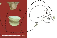 Ozdoba stará jedenáct tisíc let. Nejstarší piercing se našel v Turecku