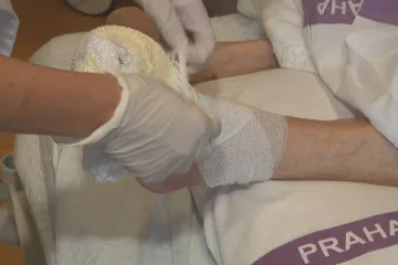 Pojišťovny by mohly nově hradit další výkony pro pacienty s nemocemi ledvin či cukrovkou