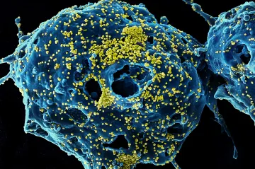 Vědci vyzkoušeli vakcínu na smrtící koronavirus MERS