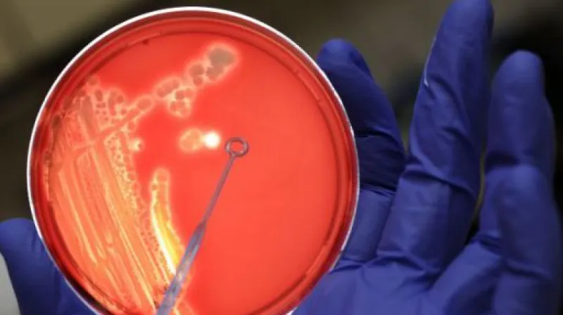 Česko má první pacientku s nebezpečnou nákazou