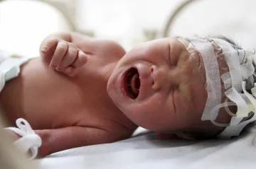 V USA se narodil chlapec z tři dekády starého embrya