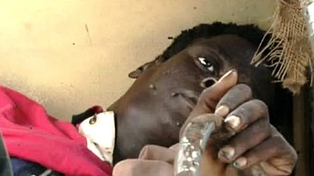 Cholera v Zimbabwe