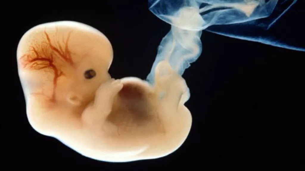 Lidské embryo