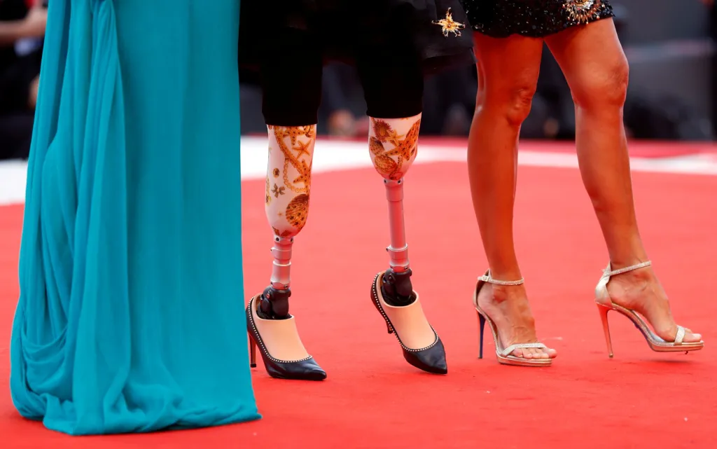 Film nemá žádné hranice a jeho hvězdy rovněž nepociťují žádné omezení. Pokud je k tomu příležitost, udělají i z handicapu přednost