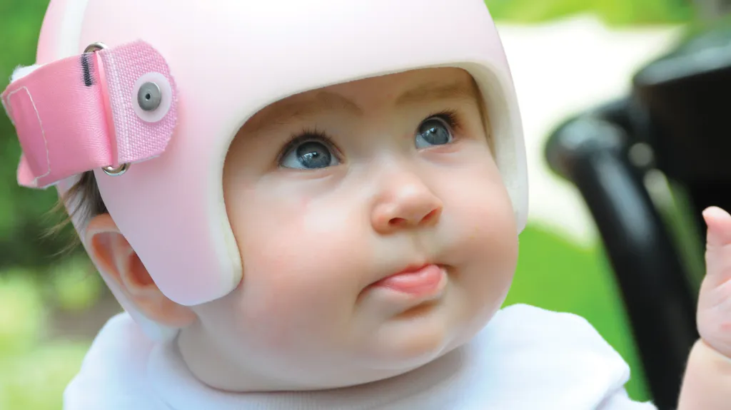 Dětská helmička pro ochranu před deformací lebky