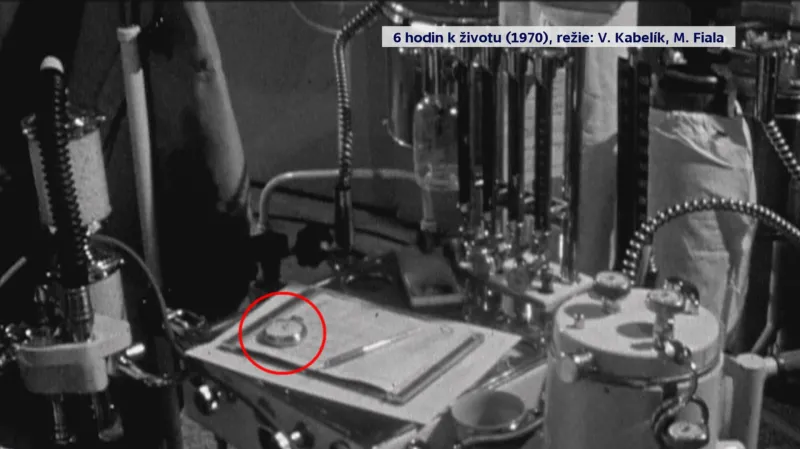 Hodinky anesteziologa (archiv)