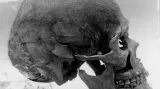 Lebka vikinského bojovníka nalezeného na Pražském hradě.