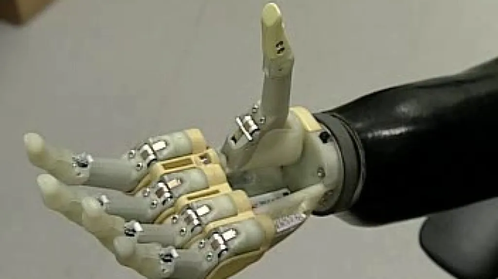 Bionická ruka