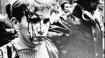 Student zraněný po potyčkách s policií v Paříži v květnu 1968