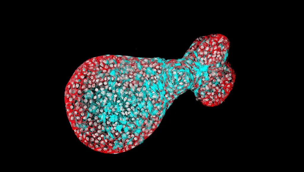 Organoid