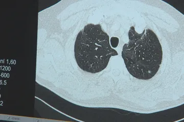 „Existuje to, ale je to naštěstí méně strašidelné,“ říká expert o následcích covidu