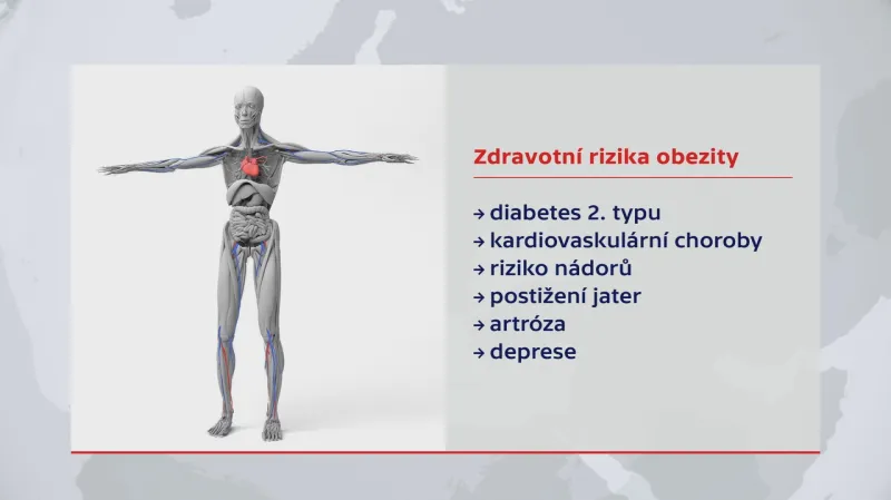 Zdravotní rizika obezity