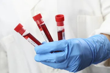 O testy na protilátky je menší zájem než na jaře. Lidé chtějí zjistit hlavně účinnost očkování