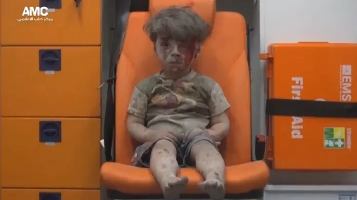 Zraněný Omrar z Aleppa