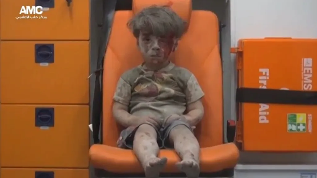 Zraněný Omrar z Aleppa