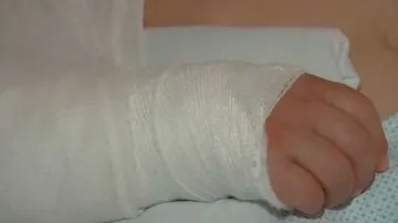 Zlomená ruka