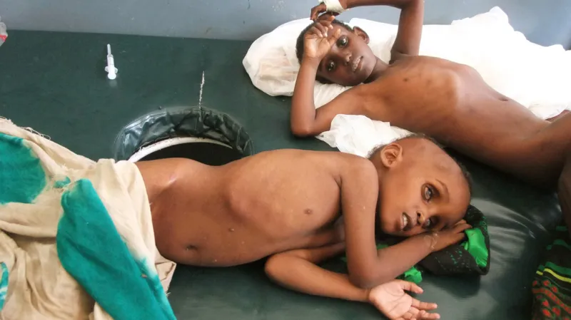 Hladomor v Somálsku