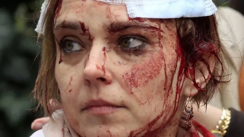 Zranění po výbuchu v Divadelní ulici