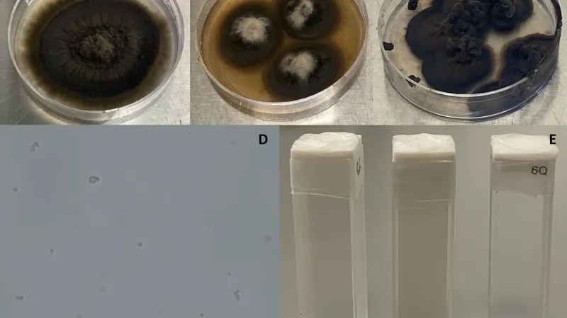 Acidofilní houby. A: Acidiella bohemica B: Acidomyces acidothermus C: Acidomyces acidophilus D: mikroskopický snímek spory E: vzorky ve zkumavkách