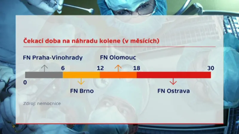 Čekací doba na náhradu kolena
