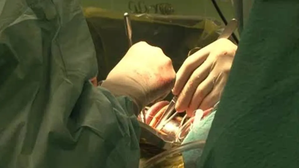 Centrum kardiovaskulární a transplantační chirurgie v Brně