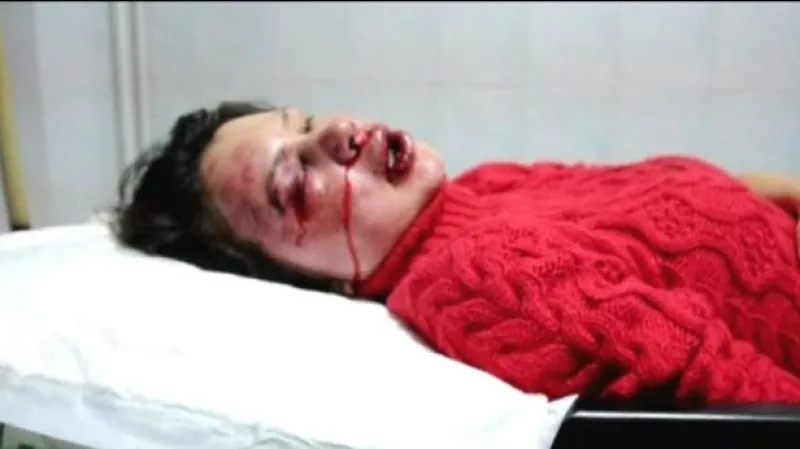 Ukrajinci demonstrovali za napadenou novinářku