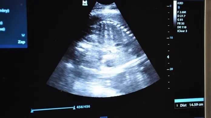 Ultrazvuk samice Janity