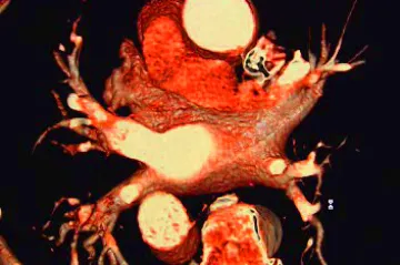 Tepající srdce se podařilo vytvořit v laboratoři