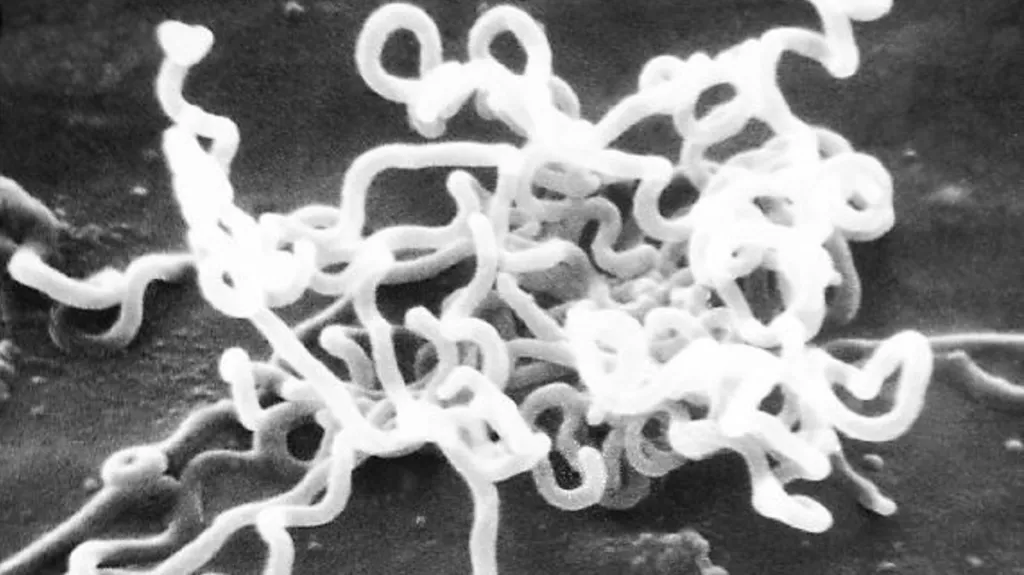Bakterie Treponema pallidum způsobuje syfilis