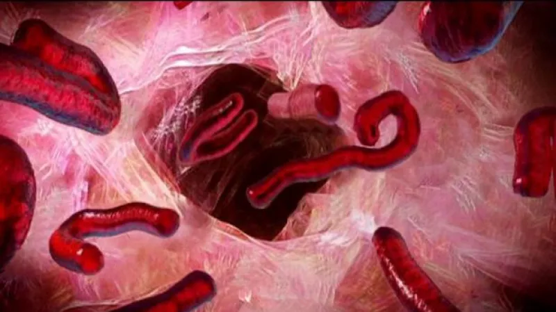 Vyděrači hrozí ebolou, vláda i hygienik uklidňují