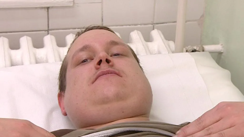 Pacient s příušnicemi (archivní snímek)