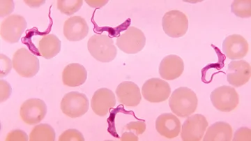 Trypanosoma spavičná, původce spavé nemoci