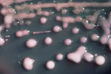 WHO varuje před hypervirulentní bakterií, která odolává antibiotikům. Problém se týká i Česka
