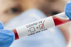 COVID-19 může mít těžký průběh i u mladých lidí, varují údaje z USA i Evropy
