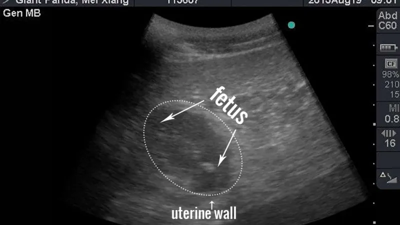 Ultrazvuk pandích dvojčat ve washingtonské zoo