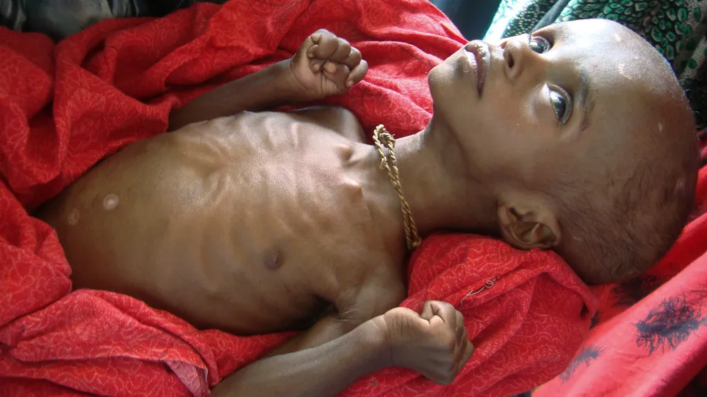 Hladomor v Somálsku
