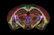 Vědci zlepšili magnetickou rezonanci. Snímek mozku je teď 64milionkrát ostřejší