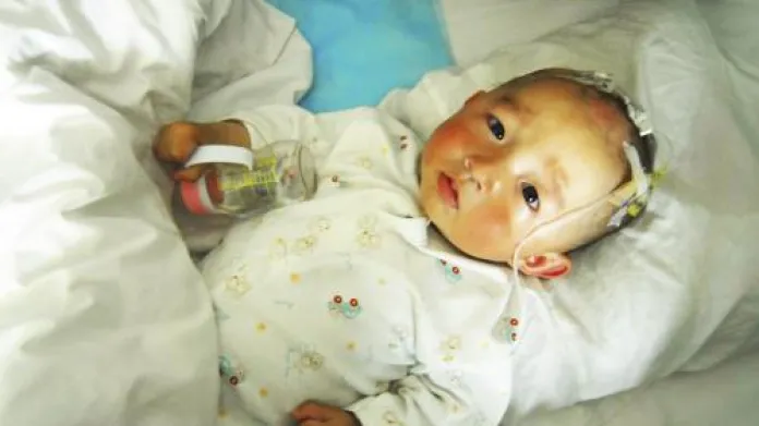 V Číně se v souvislosti s vadným sušeným mlékem léčí 1 200 dětí.