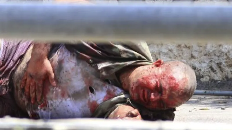 Libanonský voják po přestřelce s Izraelci