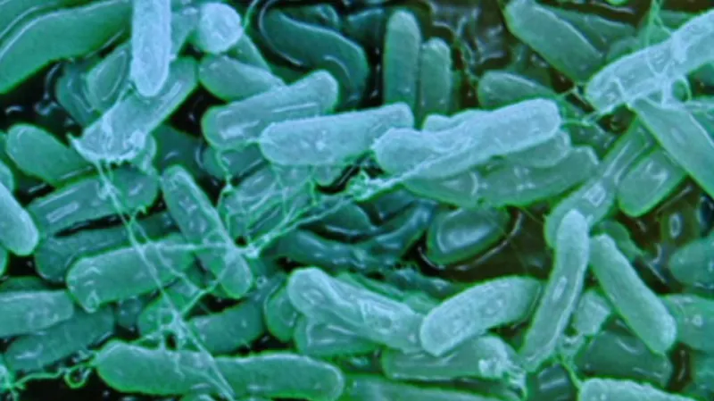 Mikrobiologická analýza