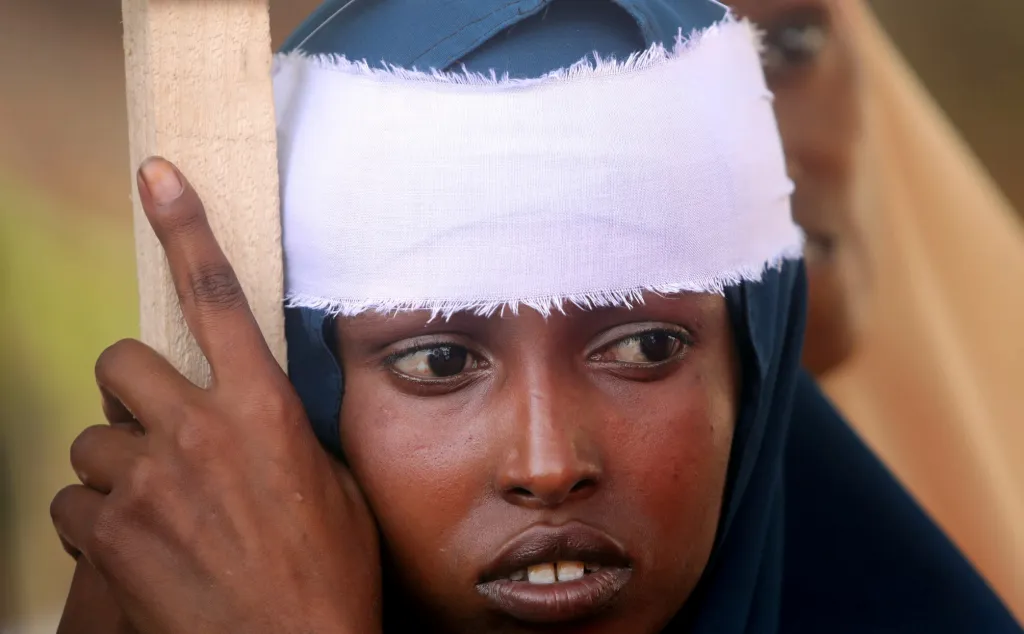 Ani v Somálsku nebyl začátek roku tím nejšťastnějším. Žena se zraněním hlavy sleduje protest proti milici Šabáb po výbuchu bomby v automobilu kousek od policejní akademie v Mogadišu 2. ledna 2020