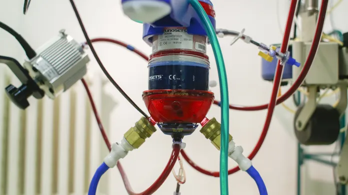 Hadičky s okysličenou a neokysličenou krví jako součást mimotělní pumpy na Jednotce intenzivní a resuscitační péče VFN v Praze