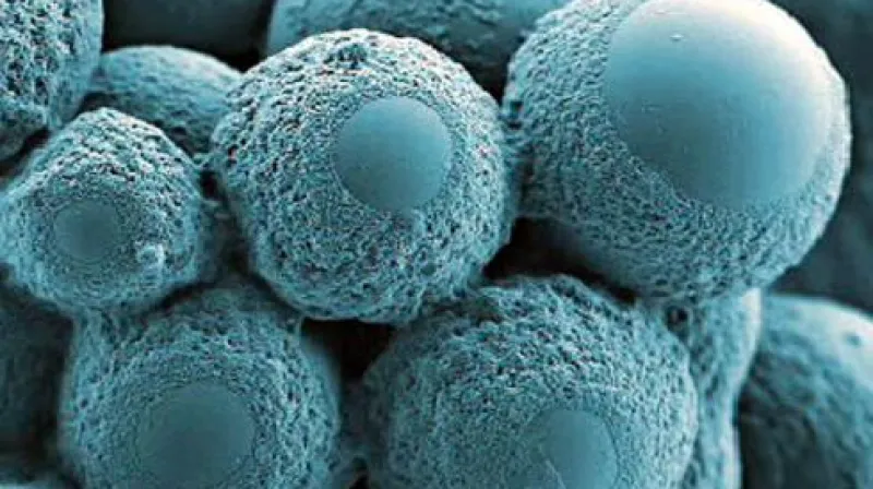 Ilustrační snímek bakterie z elektronového mikroskopu