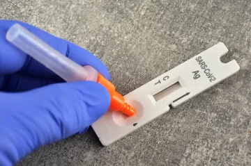 Nakažených covidem-19 v Česku mírně přibylo, počet hospitalizovaných ale klesá